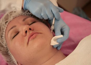 Na czym polega mikrodermabrazja diamentowa?