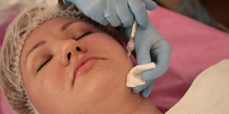 Na czym polega mikrodermabrazja diamentowa?