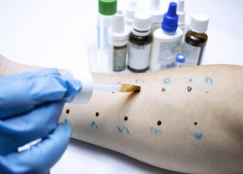 alergolog a immunolog