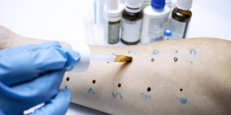 alergolog a immunolog